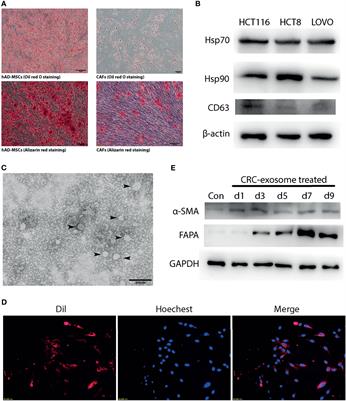 Cancer-Associated Fibroblasts Promote the Upregulation of PD-L1 Expression Through Akt Phosphorylation in Colorectal Cancer